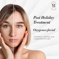 Post-holiday skin feeling dull? This graphic shows our Oxygeneo facial, which exfoliates, cleanses, and oxygenates the skin for immediate results.