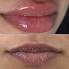 This is a clear example of neutralizing dark, cool-toned lips. The 'before' shows significant pigmentation, and the 'after' reveals a complete color shift to a warm, rosy pink. The lips appear healthier, plumper, and more vibrant.