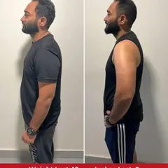 The side-profile comparison clearly shows the 10 kg weight loss, with a visibly flatter stomach and more defined upper body, highlighting the effectiveness of our transformation program.