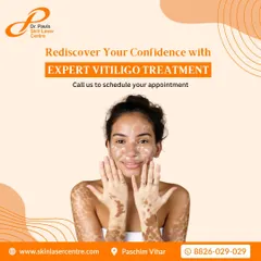 Rediscovering your confidence is a key part of the treatment journey. I offer expert vitiligo treatment designed to help you achieve clear, healthy skin and feel good about yourself.
