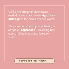 Unlike superficial acne marks, acne scars cause significant damage to the skin's deeper layers. They can be raised (hypertrophic) or depressed (atrophic), like boxcar or ice-pick scars.