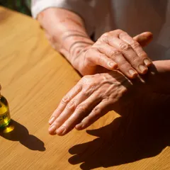 For arthritis, my Ayurvedic treatment addresses the root cause: aggravated Vata dosha. I use anti-inflammatory herbs like Guggulu and Turmeric, along with therapies like oil massage (Abhyanga) and steam (Swedana). This approach helps reduce swelling, improve joint movement, and provides sustainable relief without side effects.