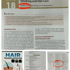 This collage shows different sections of my contribution to the "Hair Transplantation" textbook, from the cover to the specific chapter details.