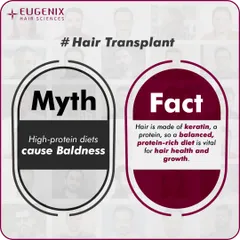 A series of graphics debunking common myths about fitness and hair loss, such as whether exercise, sweating, or high-protein diets cause baldness.