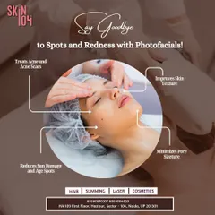 Say goodbye to spots and redness with our Photofacials. This treatment effectively treats acne, reduces sun damage, improves skin texture, and minimizes pore size for a clearer complexion.
