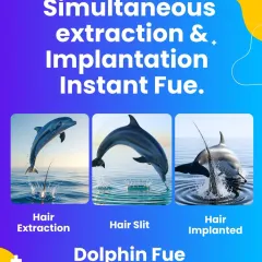 This is our Instant FUE technique, which I call the 'Dolphin FUE'. Like a dolphin jumping out of and back into the water, we extract and implant the hair graft almost simultaneously. This minimizes shock to the hair and leads to much better survival and growth.
