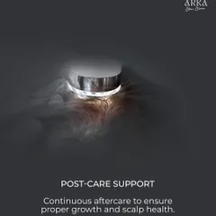 My support doesn't end after the treatment. Continuous aftercare is crucial to ensure proper hair growth and long-term scalp health.