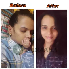 This is a powerful before and after transformation for postpartum hair loss. The first photo shows significant thinning, and the after photo shows her beautiful hair growth and recovery. My products are specifically formulated to support you through this phase.