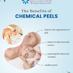 The benefits of a professionally administered chemical peel are numerous. It can significantly improve dull, tired-looking skin by enhancing tone and texture, reducing the appearance of fine lines, and minimizing pores.