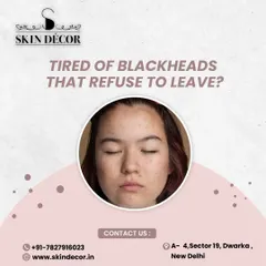 Tired of stubborn blackheads that just won't go away? I use professional methods like ultrasonic extractions to safely and effectively clear clogged pores without causing the hyperpigmentation that can result from trying to remove them at home.