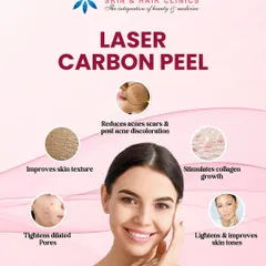 The Laser Carbon Peel, often called the 'Hollywood Peel', is an excellent treatment for improving skin texture. It works by using a carbon mask and laser to reduce acne scars, tighten dilated pores, and stimulate collagen for a smoother, more even skin tone.