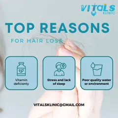 This infographic highlights three common but often overlooked reasons for hair loss: vitamin deficiencies, chronic stress and lack of sleep, and poor quality water or environmental factors. Addressing these underlying issues is a core part of our holistic treatment approach.