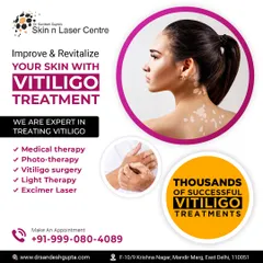 My clinic offers a complete range of Vitiligo treatments under one roof. This includes medical therapy to stop the spread, phototherapy and excimer laser to restore colour, and vitiligo surgery for stable patches.