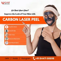 Get your glow back with a Carbon Laser Peel. This treatment delivers a youthful glow, smoother skin, an even tone, and reduced blemishes all in one session.