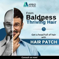 Go from baldness to thriving hair with our hair patch solution. This graphic illustrates the dramatic change possible, giving you a full head of hair and a bold new look.