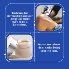 The best approach often combines professional treatments with at-home care. Procedures like microneedling and laser therapy can significantly reduce scars in just a few sessions, while scar creams can enhance and maintain those results.