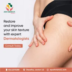 Smooth, even skin texture is achievable with the help of our expert dermatologists. We offer treatments designed to restore and improve skin affected by concerns like stretch marks, helping you feel more confident in your skin.