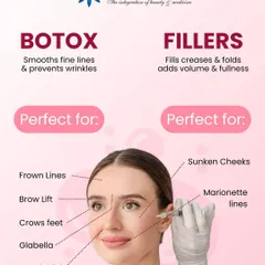 This infographic clearly explains the difference between Botox and Fillers, two of the most effective tools I use for anti-aging. Botox is for smoothing dynamic lines caused by expressions, while fillers are used to restore volume to areas like sunken cheeks. I use both to create a refreshed, natural look.