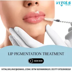 Lip pigmentation is a common concern caused by factors like sun exposure and genetics. I offer specialized treatments to safely restore the natural, even tone of your lips.