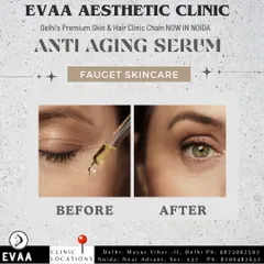 A before-and-after image demonstrating the effectiveness of our anti-aging serum treatments for the delicate under-eye area. The result is a visible reduction in fine lines and improved skin texture.