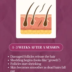 In the 1 to 3 weeks following a treatment, the damaged follicles begin to release the hairs. This shedding process can sometimes look like new growth, but it is actually the treated hairs falling out. As they shed, the skin becomes progressively smoother.