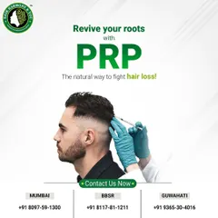 I use PRP therapy to revive your hair roots naturally. This image shows the treatment being administered to the scalp, targeting the follicles to fight hair loss effectively and safely.