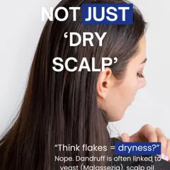 Many people think flakes mean their scalp is dry, but that's a common myth. Dandruff is often linked to an overgrowth of yeast called Malassezia, oil imbalances, and skin inflammation. Proper diagnosis is key.