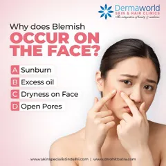 Blemishes can be caused by a variety of factors. This interactive post helps you think about the potential triggers, including sunburn, excess oil production, dryness, and open pores.