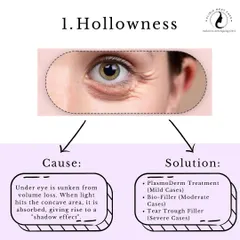 Problem: Hollowness. This is caused by volume loss, creating a shadow effect. Our solutions include PlasmoDerm for mild cases, Bio-Filler for moderate cases, and Tear Trough Filler for severe cases.