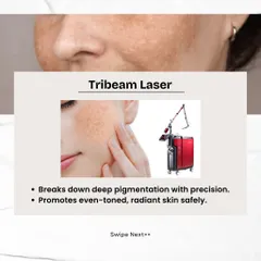 The Tribeam Laser is my go-to for deep pigmentation. It uses precise energy to break down melanin deposits safely, promoting a clear and radiant complexion.