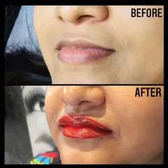 This dramatic before and after showcases the power of lip blushing. Our hands-on training teaches you how to achieve bold and beautiful results that redefine and rejuvenate the lips.