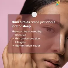 The cause of dark circles can be genetic, related to thin under-eye skin, allergies, or pigmentation issues. Understanding the root cause is the first step to effective treatment.