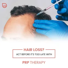 Hair loss is progressive, and early intervention is key to preventing irreversible follicle damage. PRP therapy is a proactive and effective medical treatment to address thinning hair before it becomes a more significant concern.