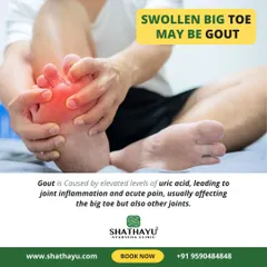 Gout is caused by elevated uric acid levels that lead to joint inflammation and acute pain, most commonly in the big toe. My treatments focus on reducing uric acid and managing the inflammation.