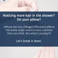 Noticing more hair on your pillow or in the shower drain? This could be Telogen Effluvium, a common form of diffuse hair loss that affects the entire scalp. Let's break down what might be causing it.