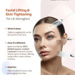 This graphic explains how Ignite RF provides a lift without surgery. It uses bipolar radiofrequency to heat and contract deeper tissue layers, tightening sagging skin on the face, jawline, and neck. It is ideal for treating mild to moderate laxity and early jowls.