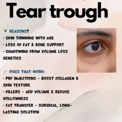 Hollowing under the eyes, or a 'tear trough', is a common concern that makes you look tired. This is often due to age-related skin thinning and volume loss. I offer solutions like PRF injections and fillers to restore volume, not just conceal the shadow.