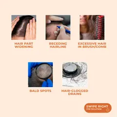 Common symptoms of hair loss include a widening hair part, a receding hairline, bald spots, and excessive hair in your brush or drain. Recognizing these signs is the first step toward finding a solution.