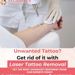 If you have tattoo regret, my laser tattoo removal service can help. I use advanced technology to help you regain your skin's natural canvas, free from unwanted ink.