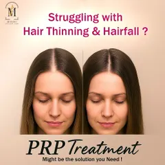 This graphic illustrates the typical outcome of PRP treatment. We move from a state of visible hair thinning and a wider parting line to a healthier scalp with improved hair volume.