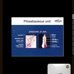 A closer look at the anatomy of a hair follicle, as shown in my presentation. Understanding this structure is fundamental to diagnosing the cause of hair loss and performing effective treatments like FUE and GFC therapy.