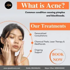 Acne is a common condition causing pimples and blackheads, but the right treatment can make all the difference. We offer personalized consultations, chemical peels, laser therapy, and ongoing support to guide you on your journey to clear skin.