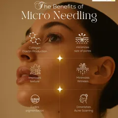 Microneedling is one of our most effective treatments for skin texture and anti-aging. This visual explains its key benefits, including boosting collagen production, minimizing pores, reducing wrinkles, and fading acne scarring and pigmentation.