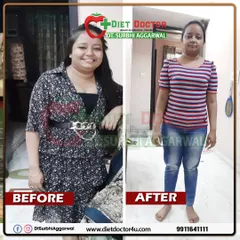This is a powerful example of how a targeted diet plan can manage chronic health conditions. This client, a chartered accountant with a history of asthma and high BP, not only lost 7 kgs in 3 months but also saw her blood pressure stabilize for the first time in years.