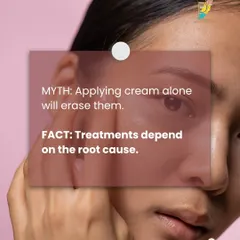 A common myth is that applying cream alone will erase dark circles. The fact is, the right treatment depends entirely on the underlying cause, which requires a professional diagnosis.