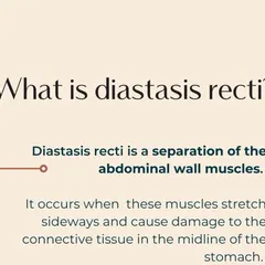What is Diastasis Recti? It's a separation of the abdominal wall muscles that happens during pregnancy. Understanding this helps in choosing the right exercises.