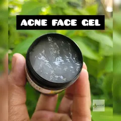 A close-up of my Acne Face Gel, showing its clear, light texture. This gel is designed to be a targeted solution for acne spots, helping to calm inflammation and promote healing.