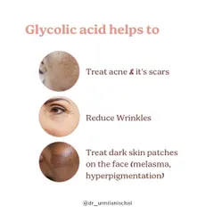 This infographic explains the many benefits of Glycolic Acid. It is a powerful AHA that helps treat acne and scars, reduce wrinkles, and fade dark patches like melasma by effectively exfoliating the skin and promoting cell turnover.
