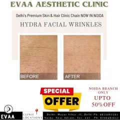 This before-and-after image shows the visible reduction of fine lines and wrinkles achieved with our specialized HydraFacial treatments.