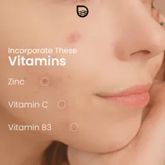 Incorporating certain vitamins and ingredients like Zinc, Vitamin C, and Vitamin B3 (Niacinamide) can support skin healing and help reduce the appearance of scars.